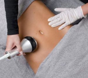 Cellulite - Cavitation