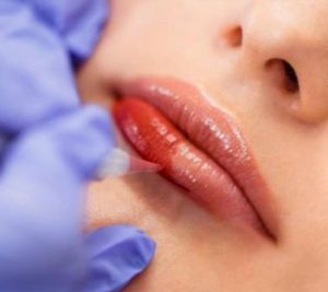 Rougissement des lèvres - Maquillage permanent