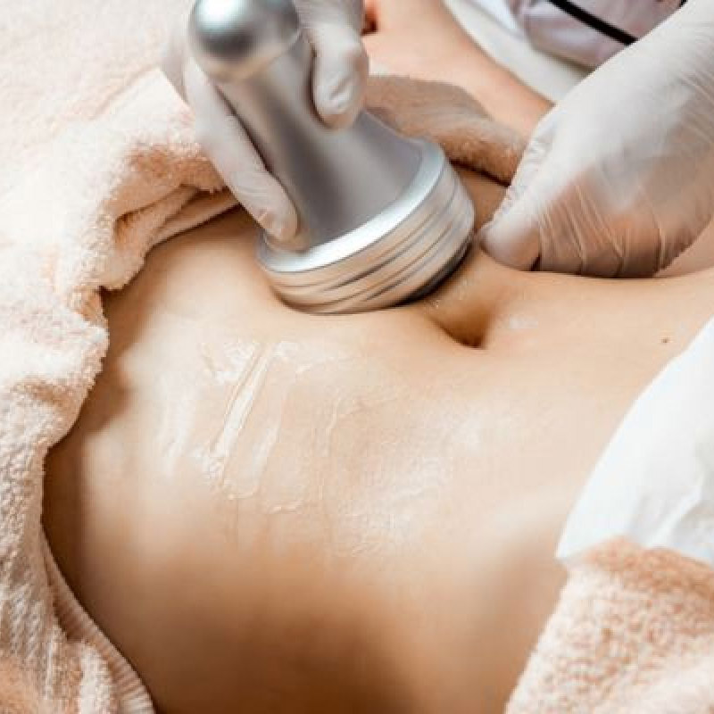 Lipocavitation et Radiofréquence - Sphère Beauté