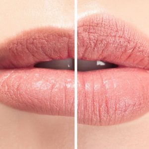 Lèvres - Esthétique