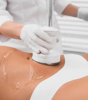 Cavitation - Réduction de la cellulite