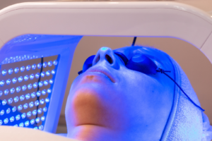 LUMINOTHERAPIE ANTI ACNÉ ANTI DEPRESSEUR