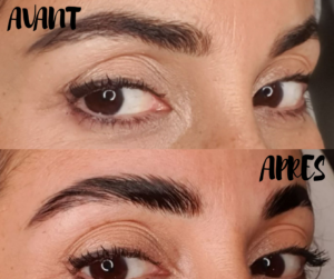 Browlift avant après